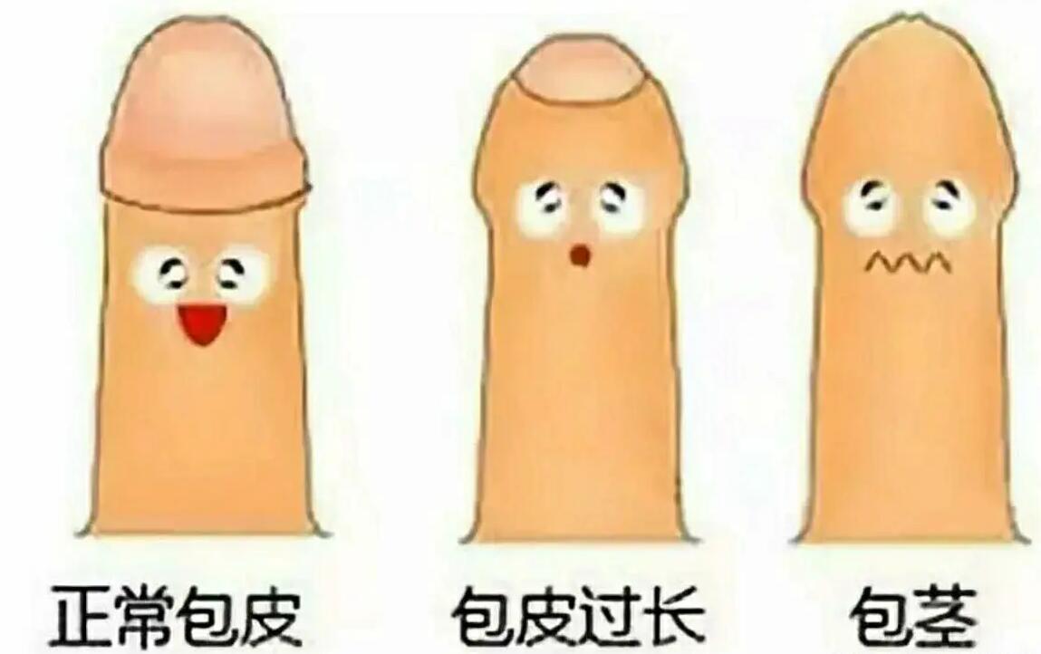 包茎图片